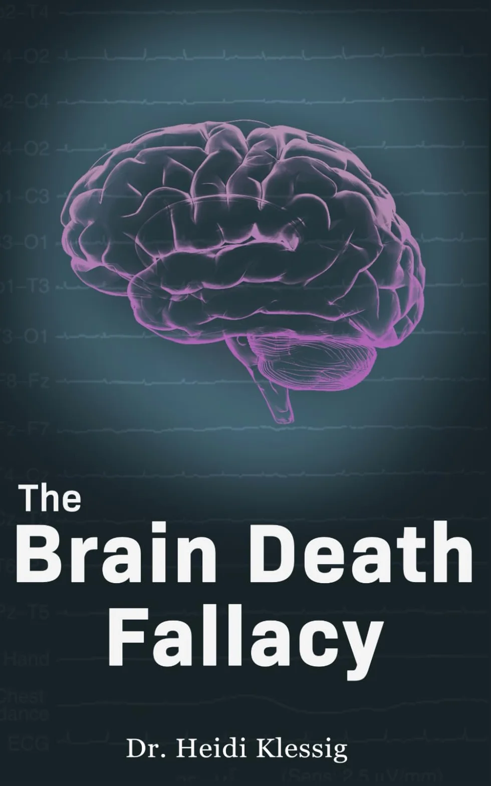 The Brain Death Fallacy